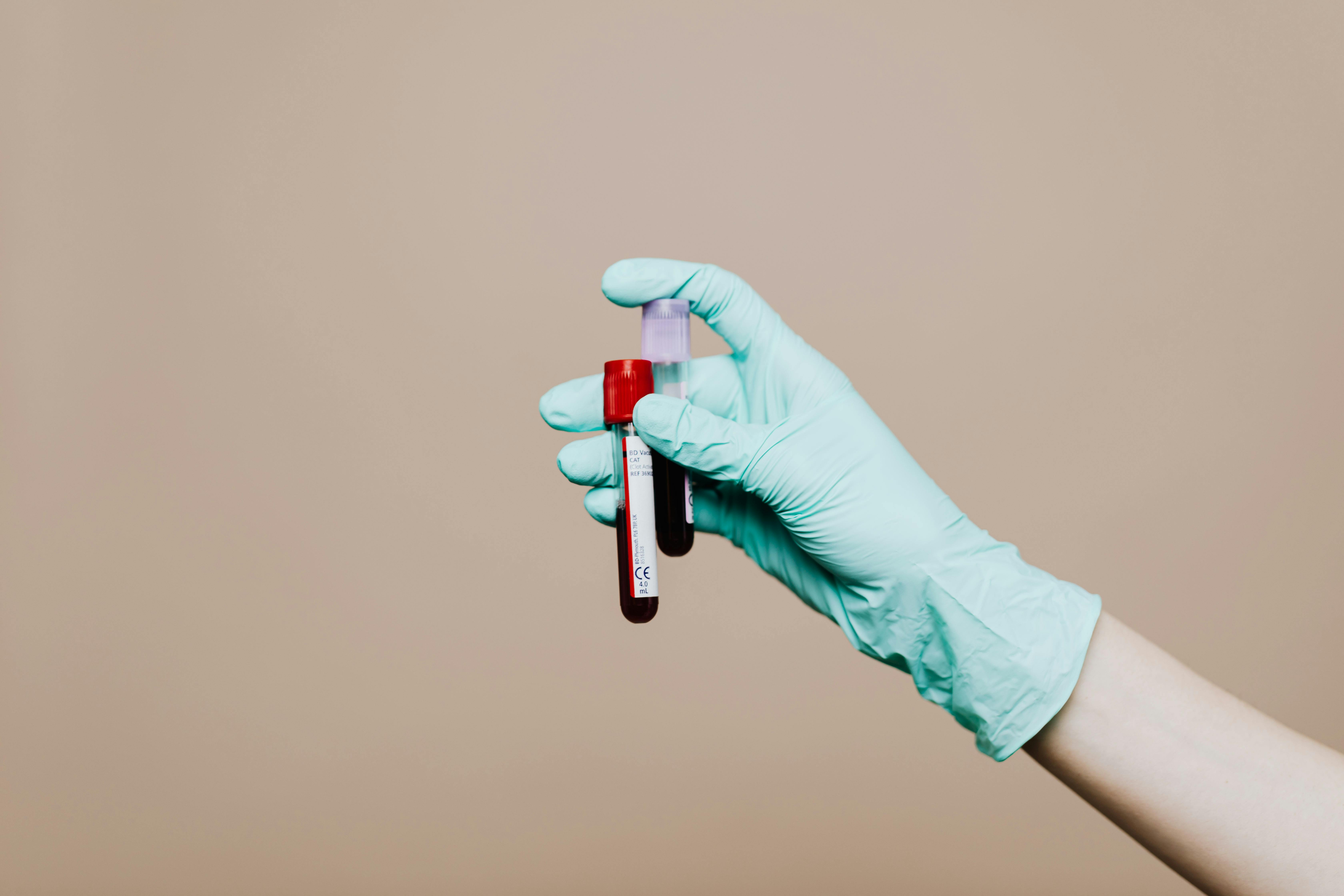 Upload Blood Test